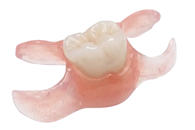 Puentes dentales