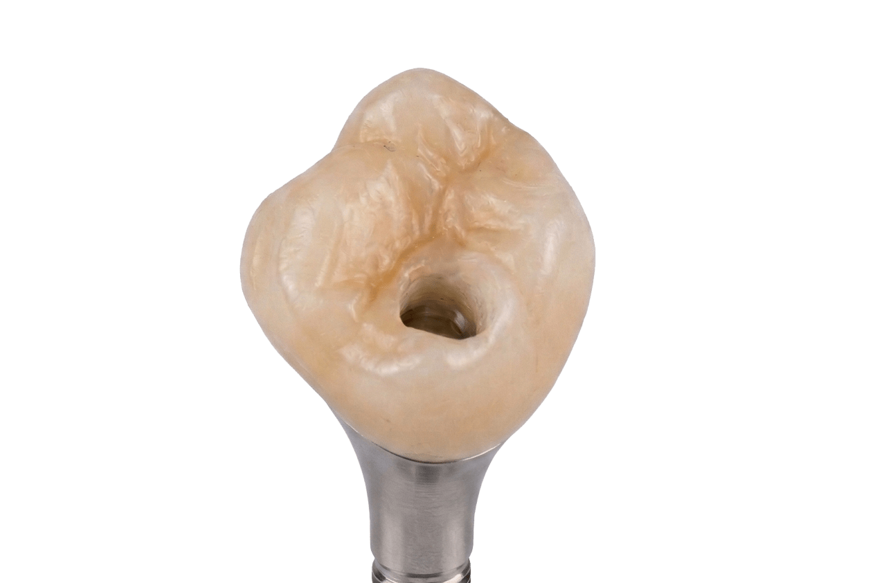 Coronas sobre implantes