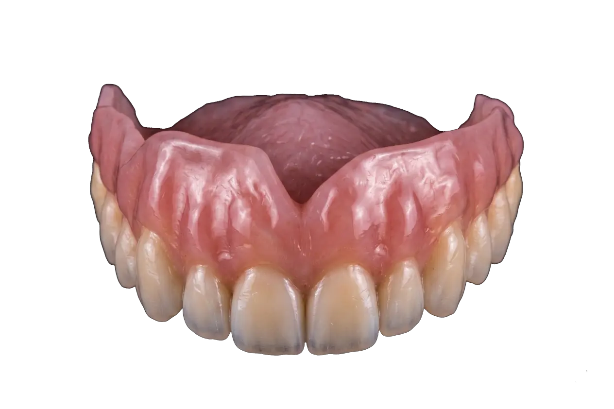 Carillas dentales