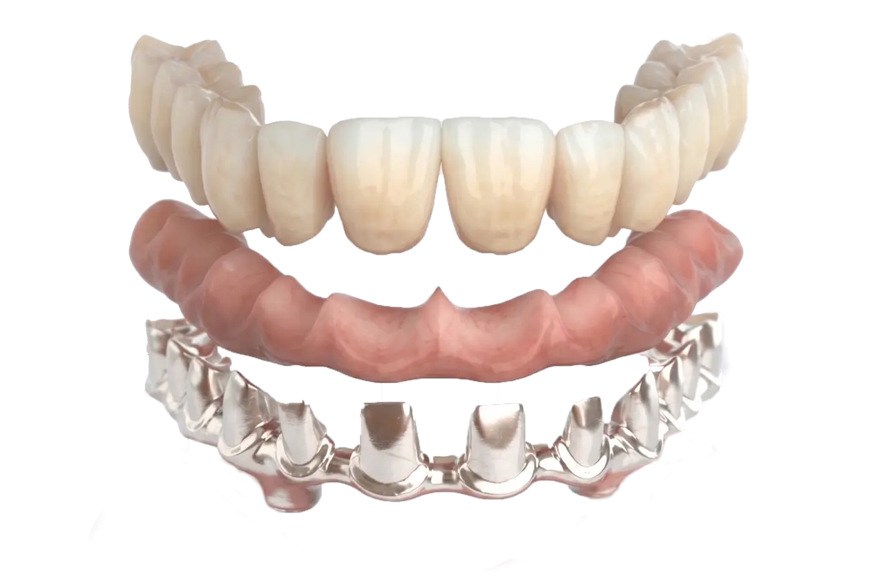Carillas dentales